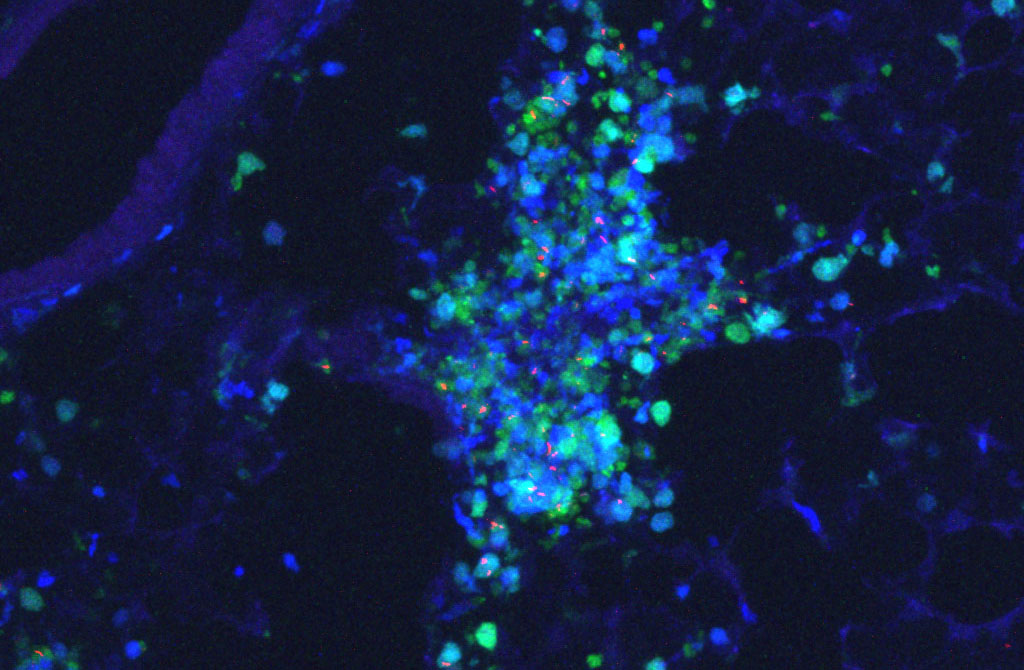 Imagerie cellulaire des mycobactéries (rouge) dans les poumons, monocytes et macrophages (bleu) et neutrophiles (vert)