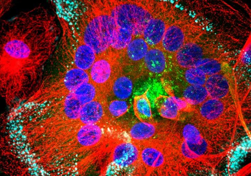 Fusion de macrophages infectés par le VIH