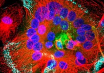 Fusion de macrophages infectés par le VIH